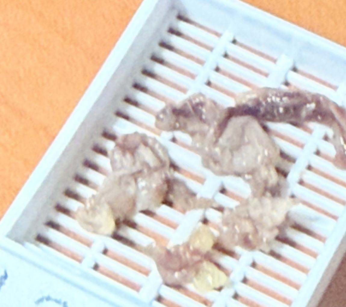 Casete de patología con varios fragmentos de tejido pleural listos para procesar