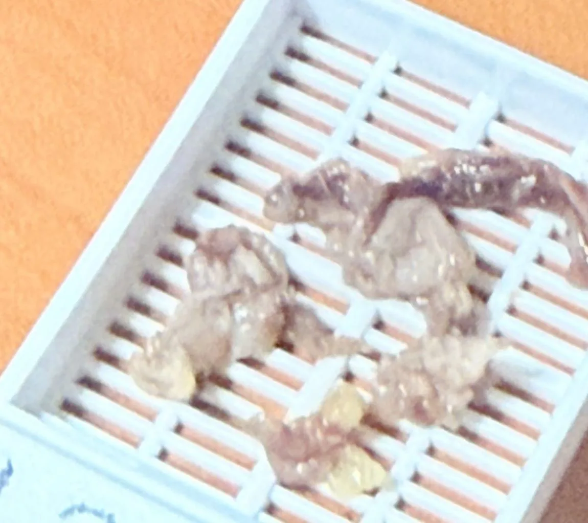 Casete de patología con varios fragmentos de tejido pleural listos para procesar