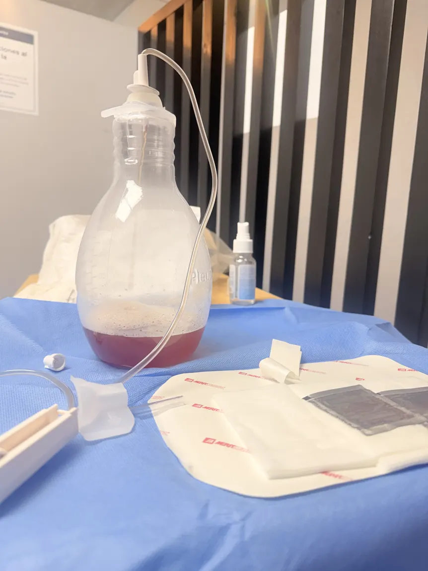 Botella de vacío para drenaje de catéter pleural junto al material de curación